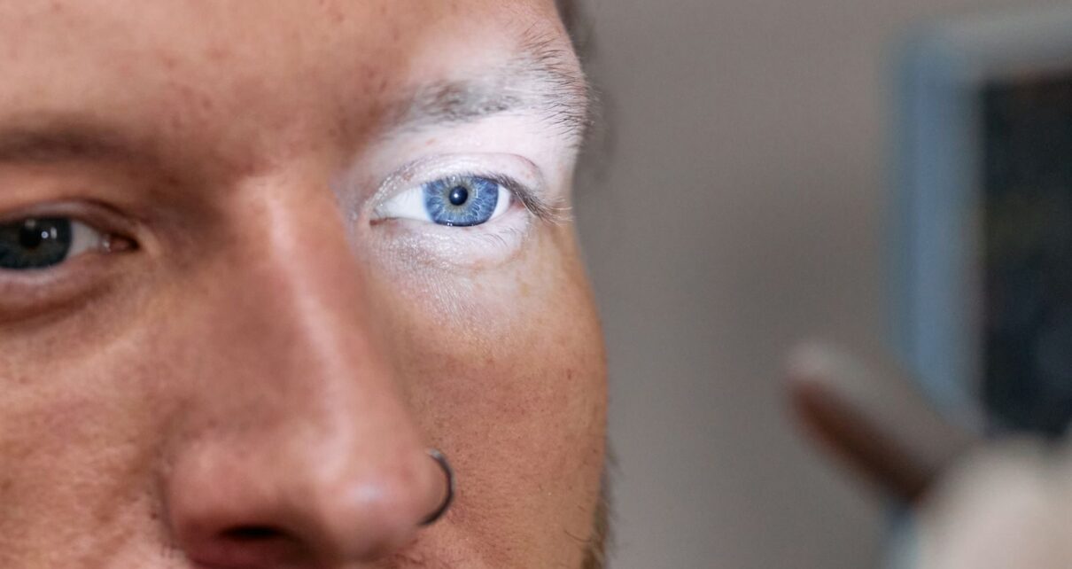 A close-up view of a man's blue eye under examination light by an ophthalmologist.