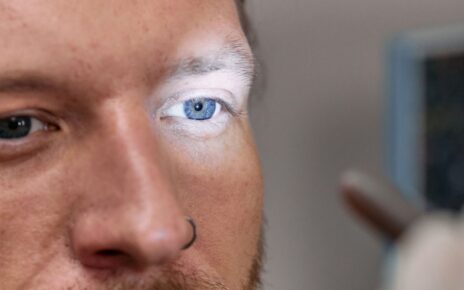 A close-up view of a man's blue eye under examination light by an ophthalmologist.